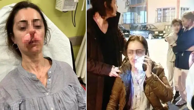 Eşinin Sevgilisi Sandığı Otomobil Kapısıyla Saldırdı!